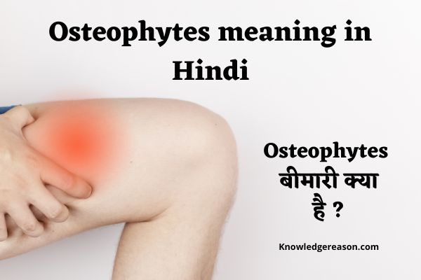 Osteophytes meaning in Hindi